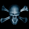 XraySkull.